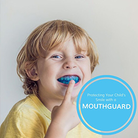 mouthguards