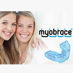 myobrace